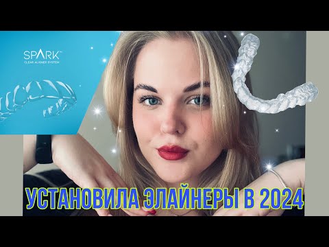 Видео: УСТАНОВИЛА ЭЛАЙНЕРЫ | МОЯ ИСТОРИЯ | ПЛЮСЫ И МИНУСЫ | СКОЛЬКО СТОИТ?