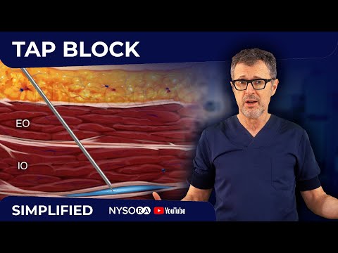 Видео: TAP BLOCK — экспресс-курс с доктором Хаджичем