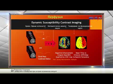 Видео: МРТ дифузия и перфузия при острия исхемичен инсулт