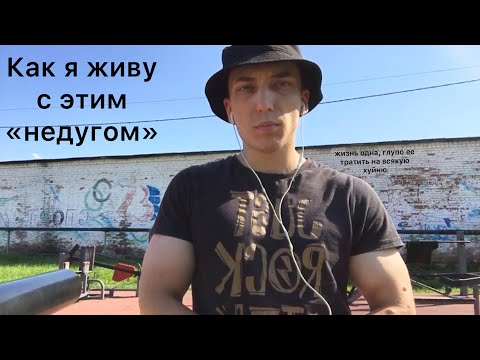 Видео: У меня нейрофиброматоз и я с этим живу.