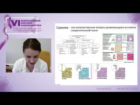 Видео: Тихонова Марина Валерьевна - Саркомы костей у детей и подростков