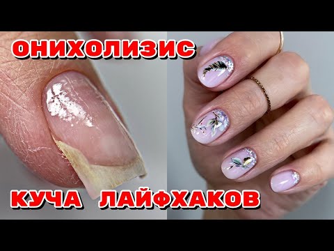 Видео: ОНИХОЛИЗИС 💅 ЛАЙФХАКИ для маникюра 💅 Дизайн ногтей со слайдерами