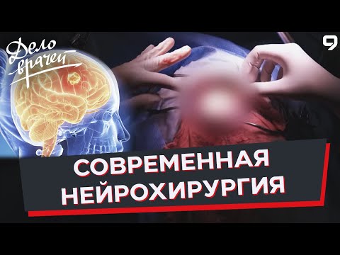 Видео: Программа "Дело врачей". Удаление опухоли мозга. Нейрохирургия. Глиобластома