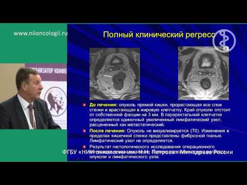 Видео: Комбинированное лечение рака прямой кишки: кому и зачем? (И.В. Правосудов)