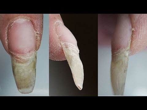 Видео: Жесть! Сломанный Ноготь! Что Делать? Виктория Авдеева