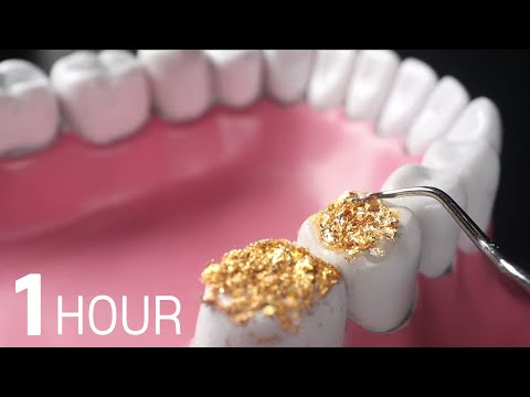 Видео: ACMP🦷 Автор мечтает стать стоматологом 1 час | Dentist Cleans Your Teeth!