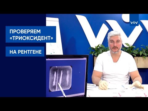 Видео: Линейка «Триоксидент». Обзор, использование, рентген