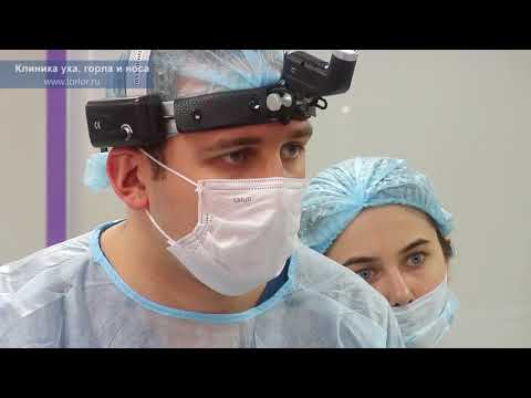 Видео: Шунтирование барабанной перепонки и аденотомия