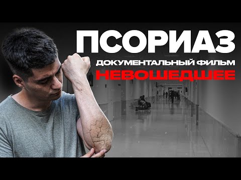 Видео: Псориаз | Невошедшее