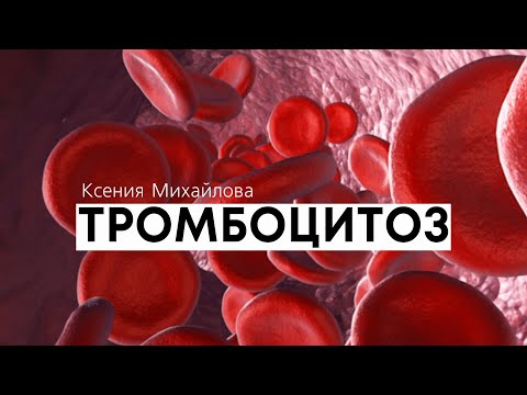 Видео: Тромбоцитоз