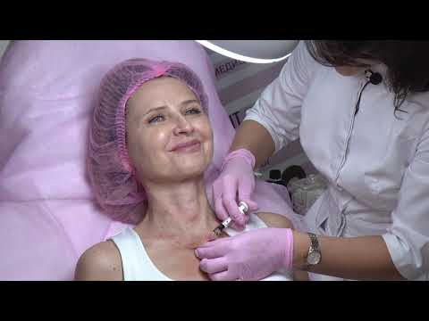 Видео: Биоревитализация шеи препаратом Профайло (Profhilo)