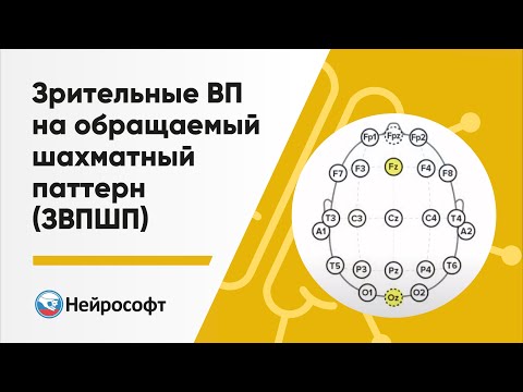 Видео: Зрительные вызванные потенциалы на обращаемый шахматный паттерн (ЗВПШП)
