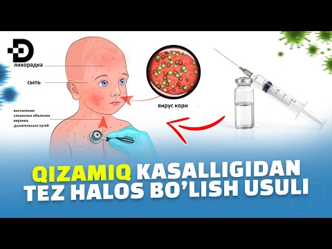 Видео: ҚИЗАМИҚ КАСАЛЛИГИДАН УЙ ШАРОИТИДА ТЕЗ ХАЛОС БЎЛИШ СИРЛАРИ