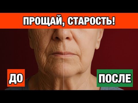 Видео: Лавровый Лист — Сильнее Ботокса, Устраняет Морщины Даже После 70 Лет