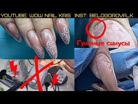 Видео: Цикличные отслойки, что делать? Грязные синусы| НЕ ПОКУПАЙТЕ ЭТОТ АППАРАТ😱
