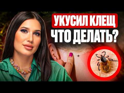 Видео: Укусил ЗАРАЖЕННЫЙ КЛЕЩ: что делать, симптомы болезни, лечение и профилактика