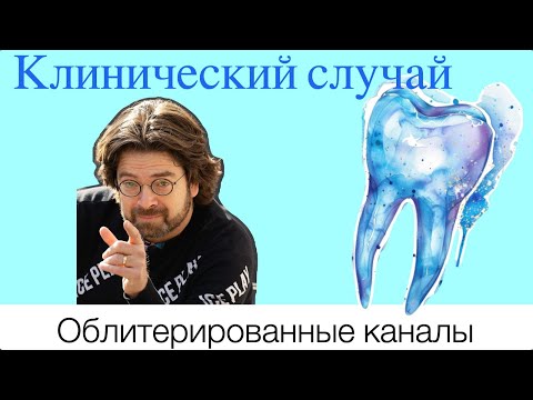 Видео: Облитерированные каналы