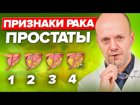 Видео: Рак простаты НЕ ПРИГОВОР! Просто обрати внимание на ЭТИ СИМПТОМЫ...