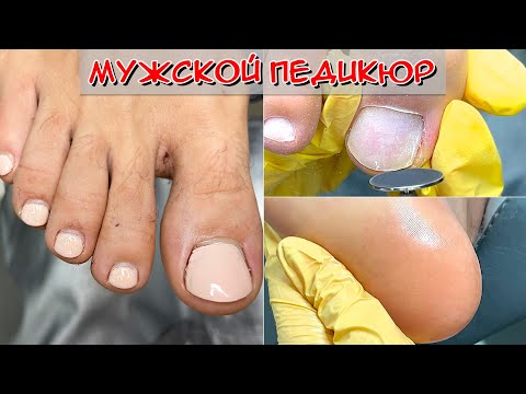 Видео: Мужской педикюр 🦶 / Обработка пяток аппаратом