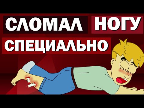 Видео: КАК Я СЛОМАЛ НОГУ (Анимация). Мои детские травмы. Перелом.