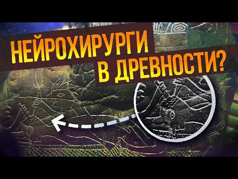 Видео: Андрей Жуков: Камни Ики - Древняя медицина