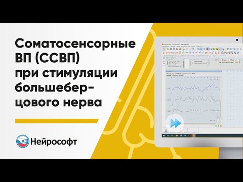 Видео: Соматосенсорные вызванные потенциалы (ССВП) при стимуляции большеберцового нерва