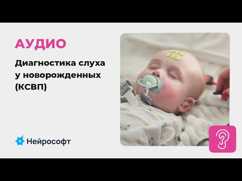 Видео: Аудиология: Диагностика слуха у новорожденных. Регистрация КСВП