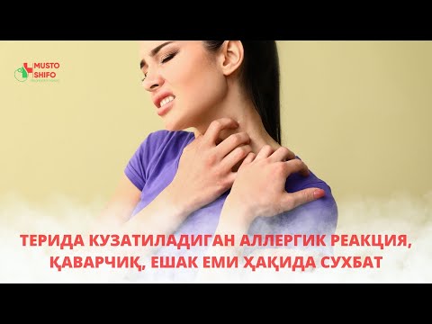 Видео: ТЕРИДА КУЗАТИЛАДИГАН АЛЛЕРГИК РЕАКЦИЯ ҲАҚИДА. ҚАВАРЧИҚ. ЕШАК ЕМИ ҲАҚИДА СУХБАТ