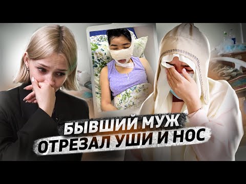 Видео: «Не могу смотреть на себя в зеркало» | Асель