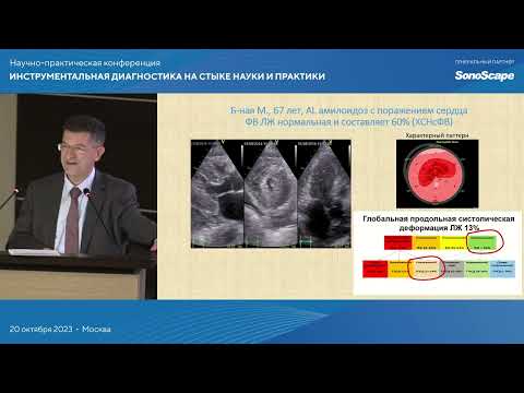 Видео: Спекл-трекинг эхокардиография в повседневной практике. Алёхин М.Н