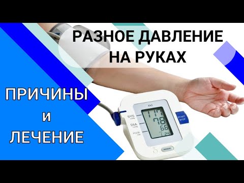 Видео: РАЗНОЕ ДАВЛЕНИЕ НА РУКАХ: причины и лечение
