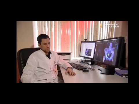 Видео: Радийодтерапия. Радионуклид диагностика ва терапия хакида маьлумотлар