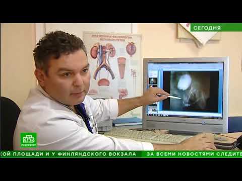 Видео: Восстановление уретры в КБ № 122