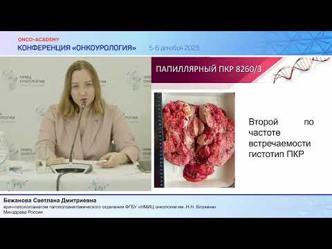 Видео: Современная патоморфологическая классификация опухолей почки. Бежанова С. Д.
