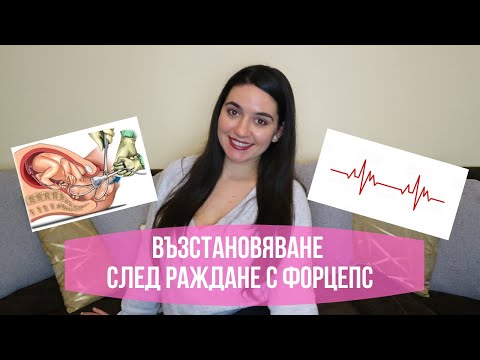 Видео: ВЪЗСТАНОВЯВАНЕ СЛЕД РАЖДАНЕ С ФОРЦЕПС:епизиотомия,болки,Q&A и още...