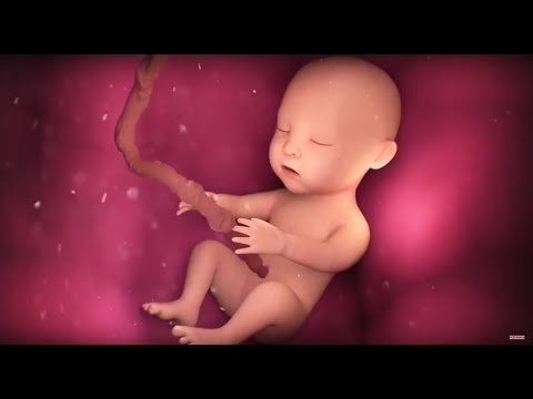 Видео: ДЦП – что это? / Здравствуйте