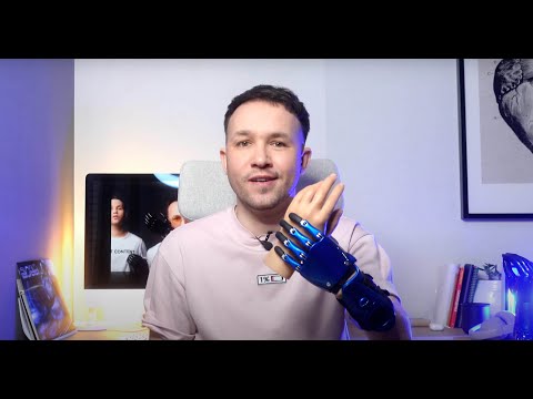 Видео: Как получить протез руки?