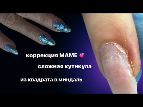 Видео: из квадрата в миндаль | травмированный ноготь | сложная кутикула
