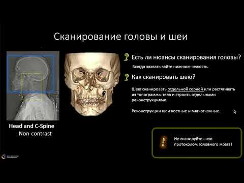 Видео: Пан КТ при политравме