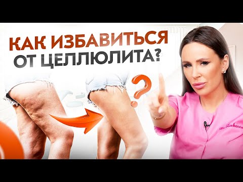 Видео: ЭТО 100% обеспечит тебя целлюлитом! Как избавиться от целлюлита?