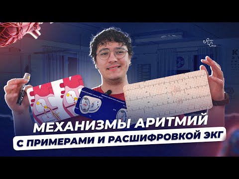 Видео: Механизмы аритмий  С примерами и расшифровкой ЭКГ