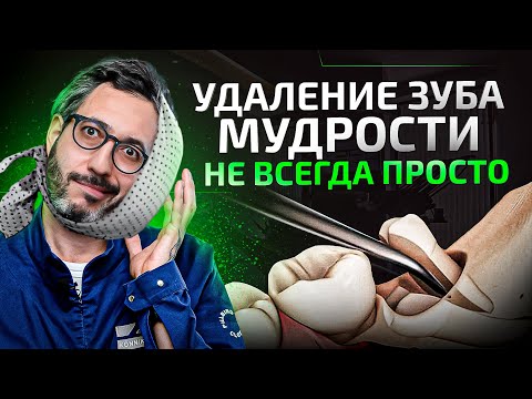 Видео: Почему у кого-то легко, а у кого-то тяжело проходит удаление зубов и реабилитация?