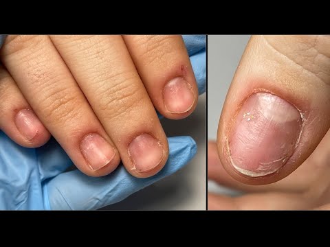 Видео: Перепиленные ногти😢,  что же сделать / моделирование