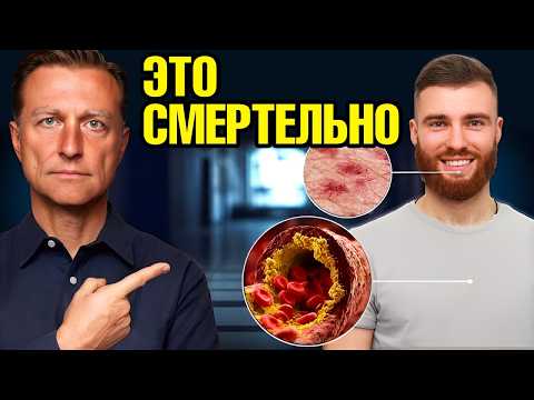 Видео: Самые ОПАСНЫЕ болезни, у которых нет симптомов😲