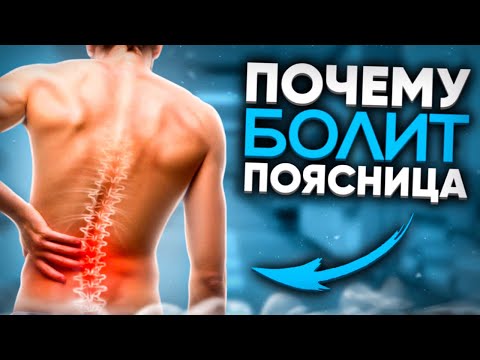 Видео: Всё про БОЛЬ В ПОЯСНИЦЕ | Протрузии, грыжи, нарушения осанки и упражнения, которые Вам НЕ помогут