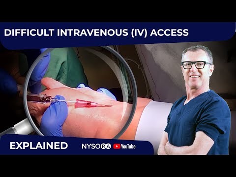 Видео: Как поставить сложную внутривенную катетеризацию или взять образец крови у пациентов с проблемным...