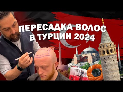 Видео: Мой опыт пересадки волос в Турции 2024г | Цена, боль, сервис