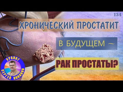 Видео: Хронический простатит в будущем рак простаты?
