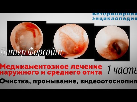 Видео: Лечение наружного и среднего отита. Очистка, промывание, видеоотоскопия