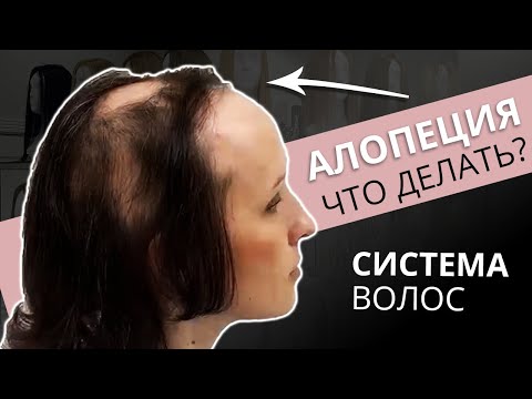 Видео: КОРРЕКЦИЯ СИСТЕМЫ multi top.